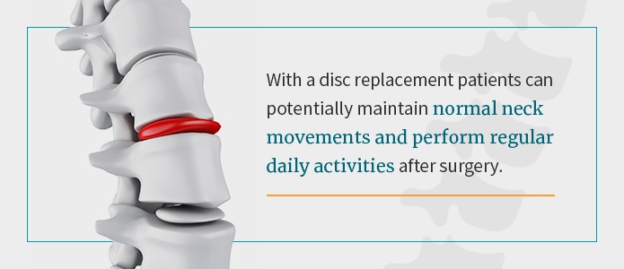 Benefits-of-Disc-Replacement
